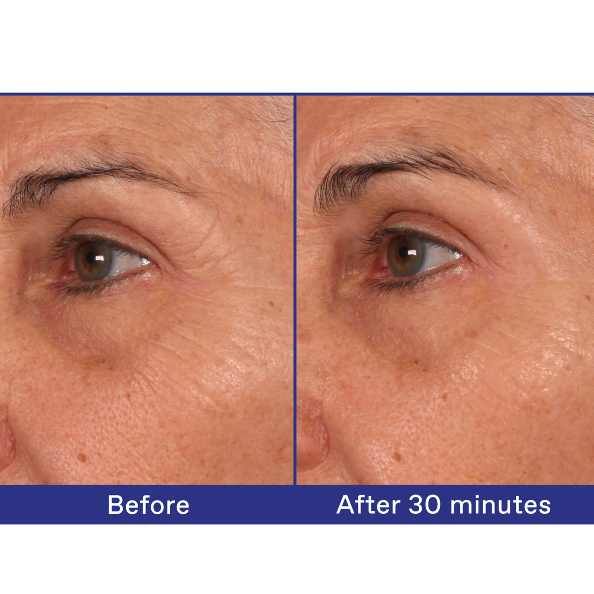 Korres White Pine Meno-Reverse™ Deep Wrinkle, Plumping + Age Spot Concentrate sold by A Velvet Window