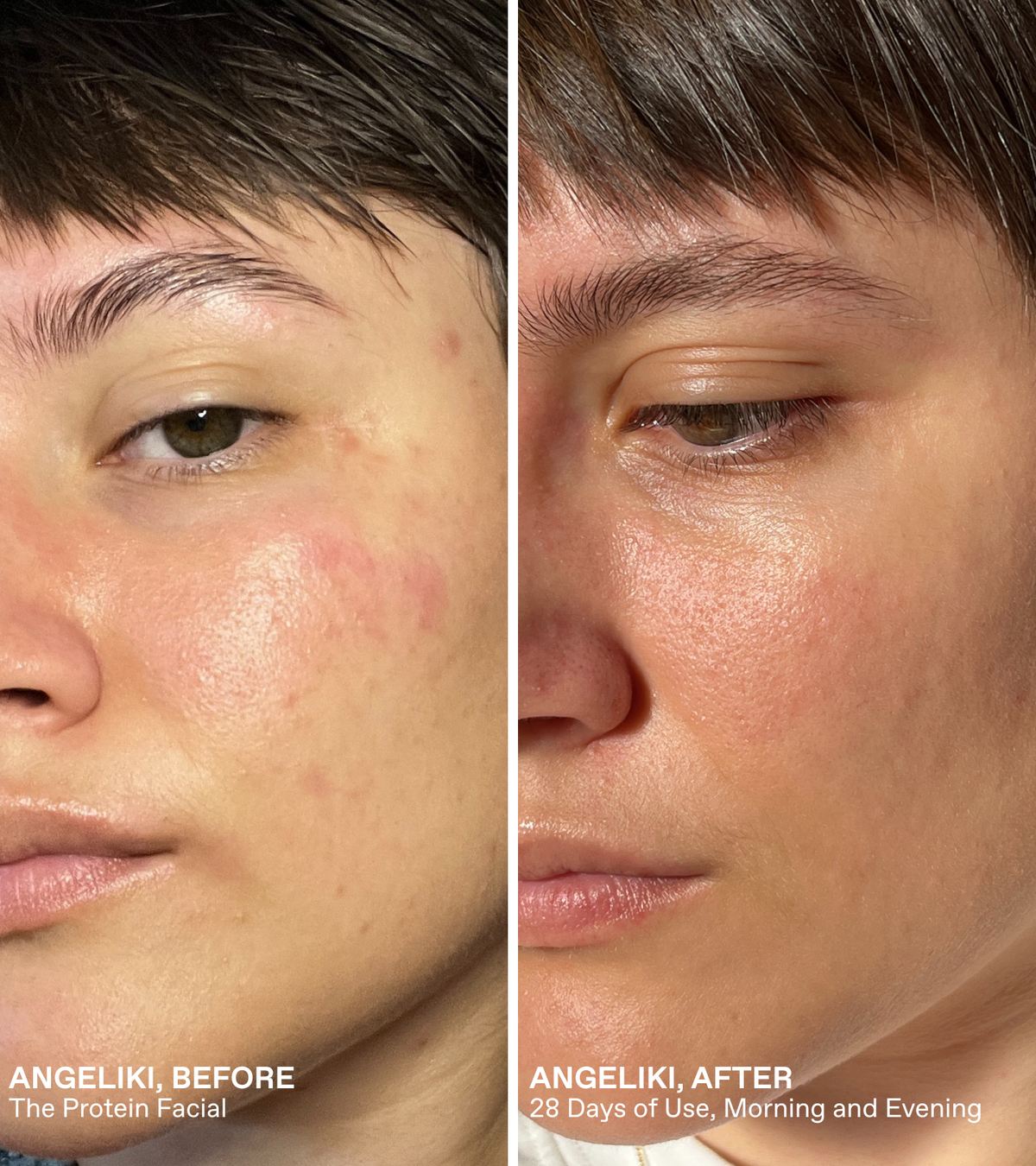 Korres Protein Facial Kit sold by A Velvet Window